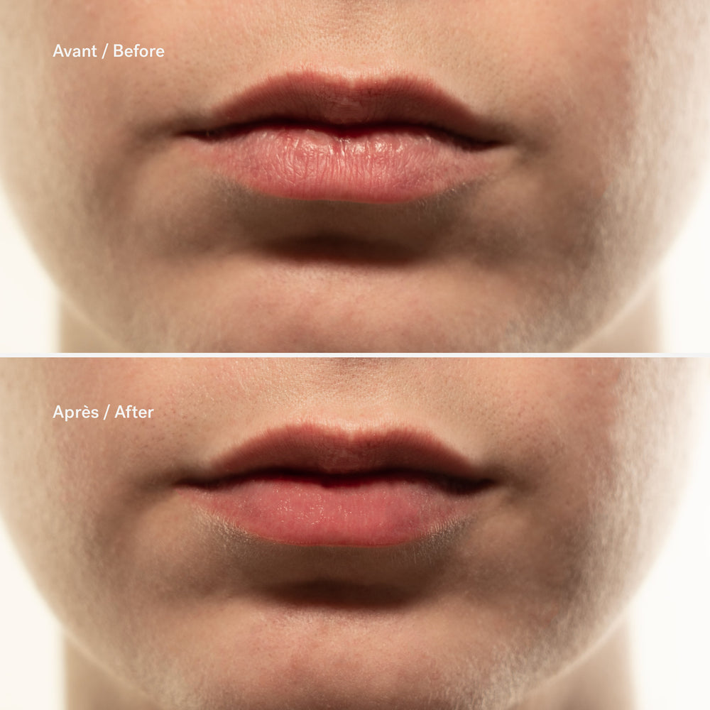 Overnight Repairing Lip Mask 1% Ceramides + Hyaluronic Acid — Typology