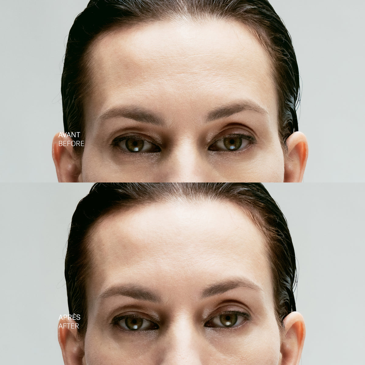 Targeted Skin-Tightening Concentrate 10% Inhibiting Peptide Complex + Hyaluronic Acid — Typology