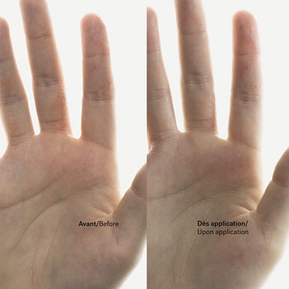 Itch Relief Cream 0.15% Enoxolone + Bisabolol — Typology