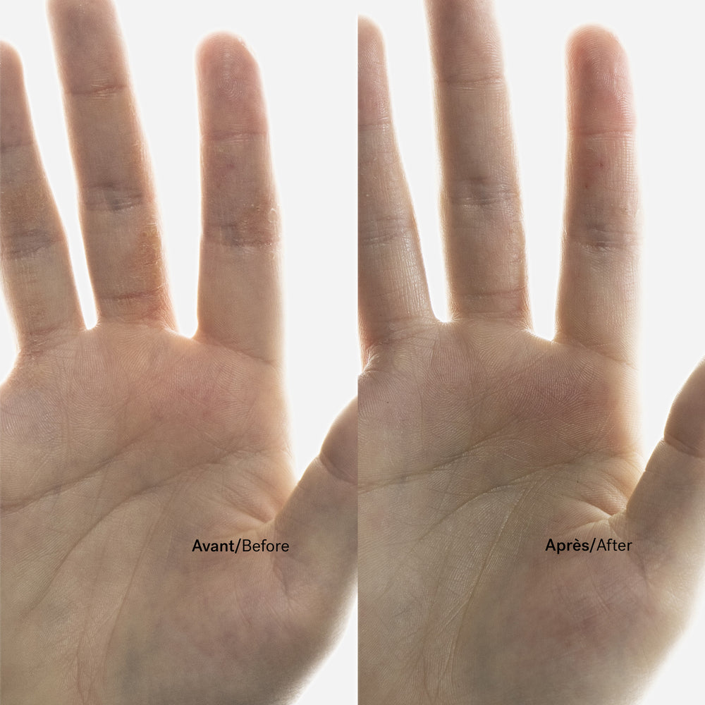 Atopic Skin Trio