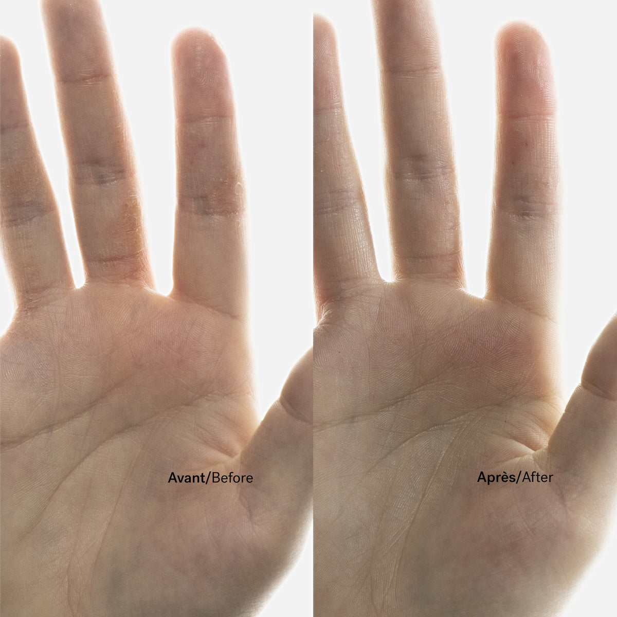 Atopic Skin Trio