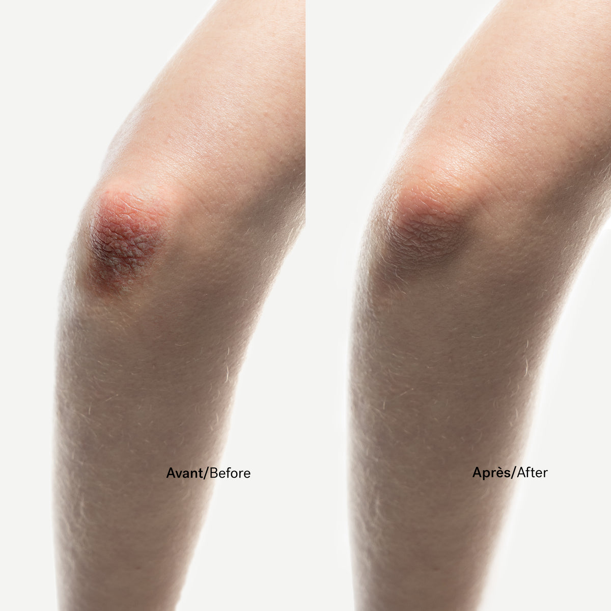 Repairing Cica-Balm 0.5% Zinc-Copper Complex + Centella Asiatica — Typology