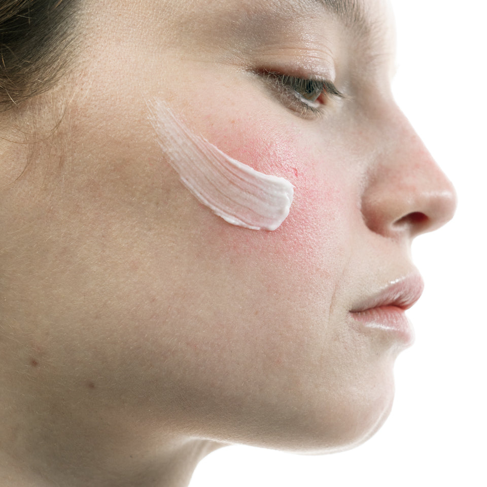 Redness Relief Face Moisturizer Azelaic Acid 5% + Niacinamide — Typology